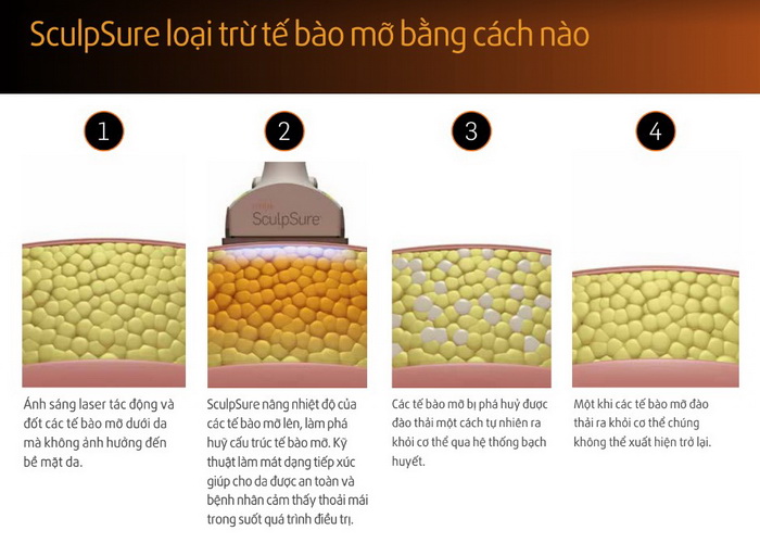 nguyên lý giảm béo của máy giảm béo sculpsure giam beo sculpsure 3.jpg (98 KB)